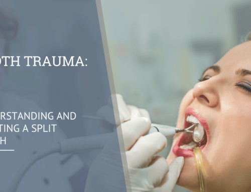 Tooth Trauma: Understanding and Treating a Split Tooth