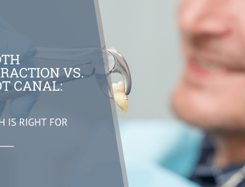 Tooth Extraction vs. Root Canal: Which is Right for You?